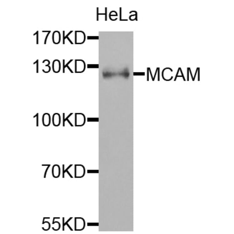 Anti-MCAM Antibody from Bioworld Technology (BS7708) - Antibodies.com