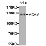 Anti-MCAM Antibody from Bioworld Technology (BS7708) - Antibodies.com