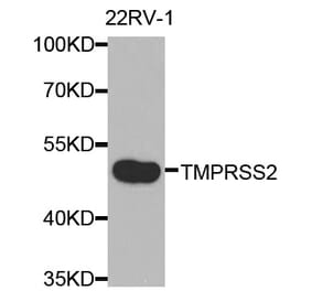 Anti-TMPRSS2 Antibody from Bioworld Technology (BS7711) - Antibodies.com