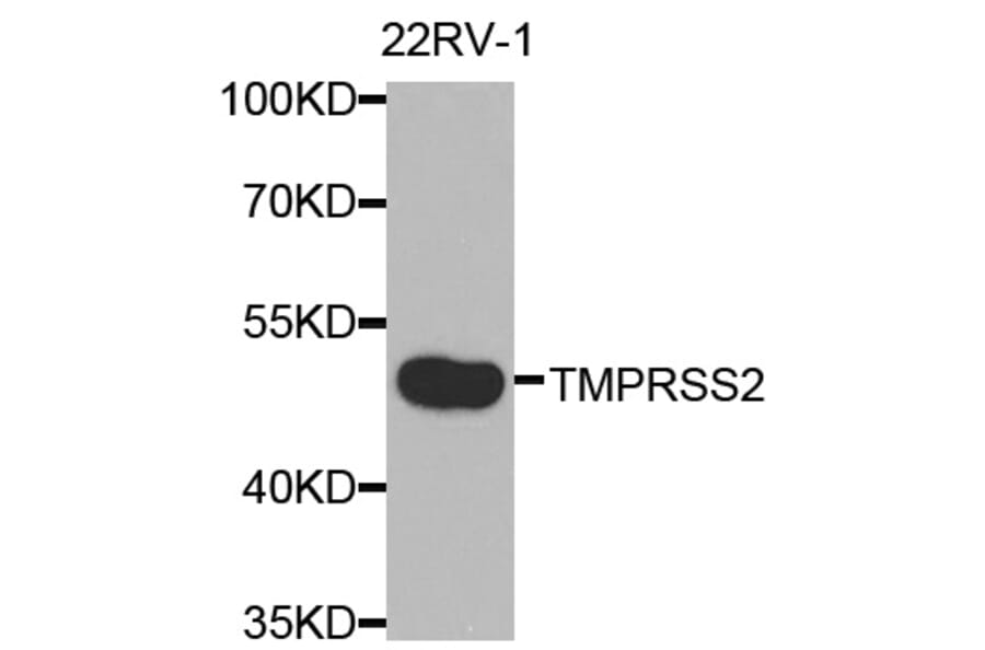 Anti-TMPRSS2 Antibody from Bioworld Technology (BS7711) - Antibodies.com