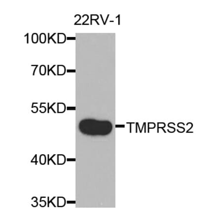 Anti-TMPRSS2 Antibody from Bioworld Technology (BS7711) - Antibodies.com