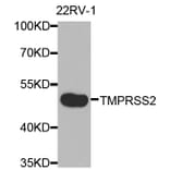 Anti-TMPRSS2 Antibody from Bioworld Technology (BS7711) - Antibodies.com