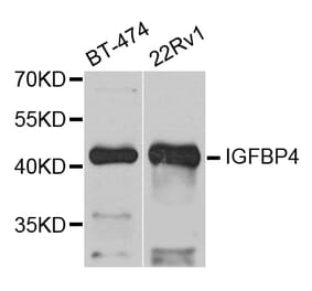 Anti-IGFBP4 Antibody from Bioworld Technology (BS7714) - Antibodies.com