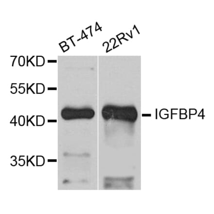 Anti-IGFBP4 Antibody from Bioworld Technology (BS7714) - Antibodies.com