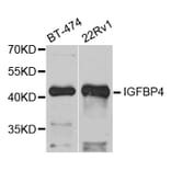 Anti-IGFBP4 Antibody from Bioworld Technology (BS7714) - Antibodies.com