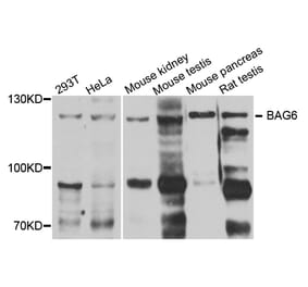 Anti-BAT3 Antibody from Bioworld Technology (BS7715) - Antibodies.com
