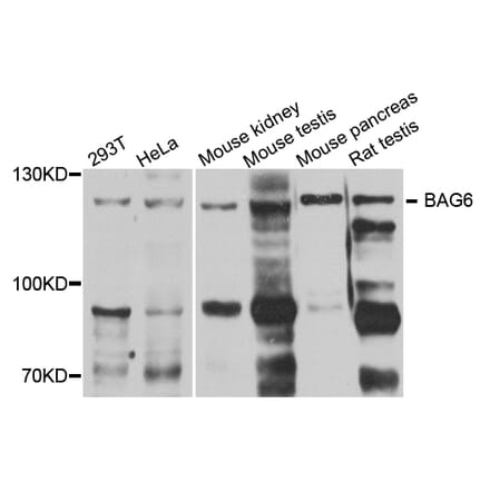 Anti-BAT3 Antibody from Bioworld Technology (BS7715) - Antibodies.com