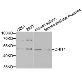 Anti-CHIT1 Antibody from Bioworld Technology (BS7716) - Antibodies.com
