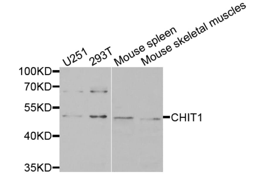 Anti-CHIT1 Antibody from Bioworld Technology (BS7716) - Antibodies.com
