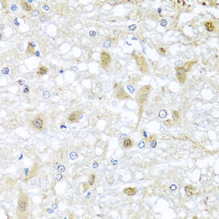Anti-ATP2C1 Antibody from Bioworld Technology (BS7724) - Antibodies.com