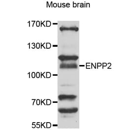 Anti-ENPP2 Antibody from Bioworld Technology (BS7725) - Antibodies.com