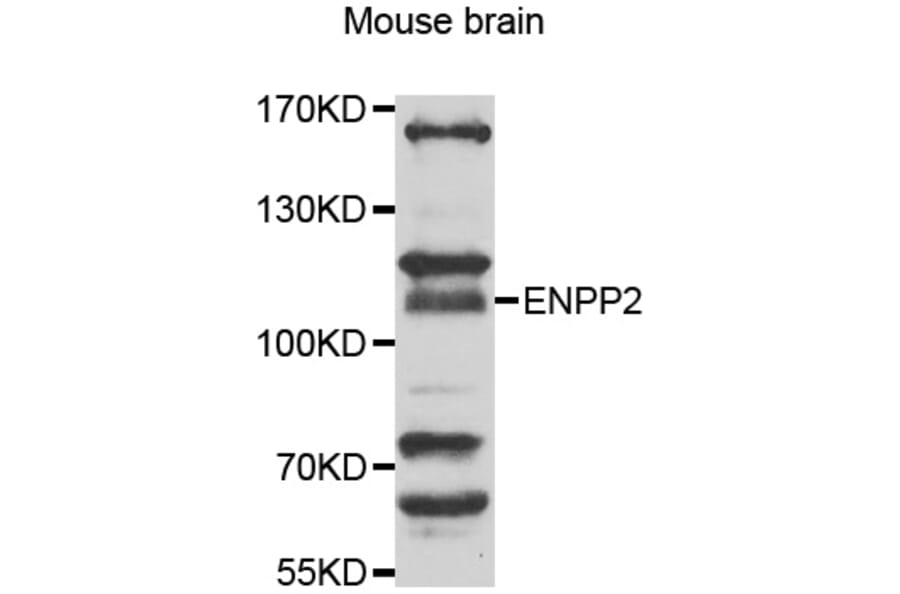 Anti-ENPP2 Antibody from Bioworld Technology (BS7725) - Antibodies.com
