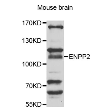 Anti-ENPP2 Antibody from Bioworld Technology (BS7725) - Antibodies.com