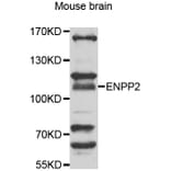Anti-ENPP2 Antibody from Bioworld Technology (BS7725) - Antibodies.com