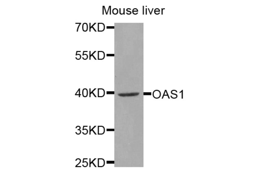 Anti-OAS1 Antibody from Bioworld Technology (BS7726) - Antibodies.com