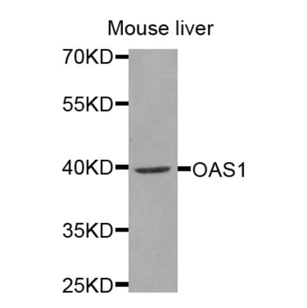 Anti-OAS1 Antibody from Bioworld Technology (BS7726) - Antibodies.com