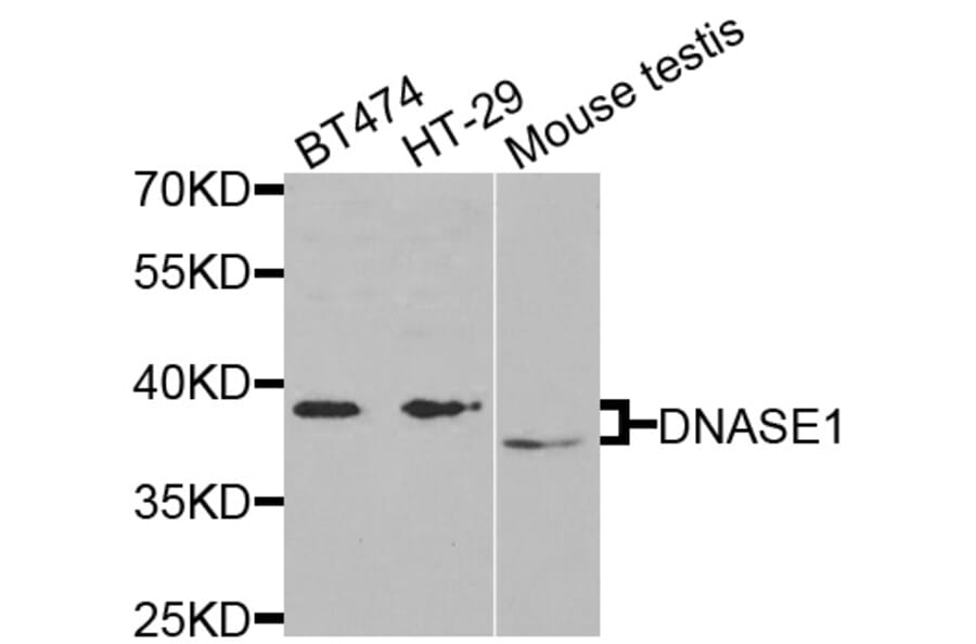 Anti-DNASE1 Antibody from Bioworld Technology (BS7729) - Antibodies.com
