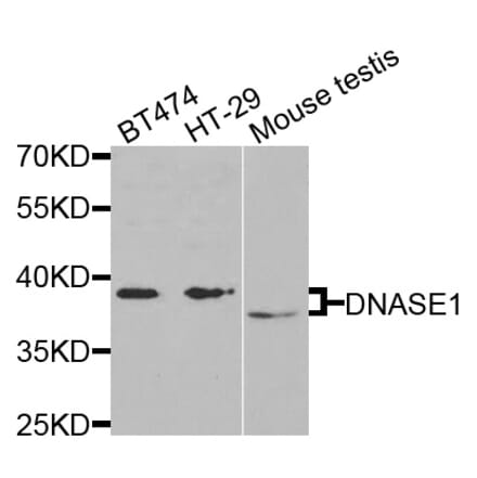 Anti-DNASE1 Antibody from Bioworld Technology (BS7729) - Antibodies.com