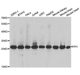 Anti-TPI1 Antibody from Bioworld Technology (BS7732) - Antibodies.com