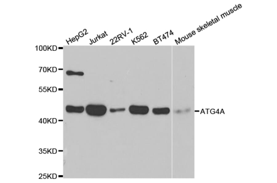 Anti-ATG4A Antibody from Bioworld Technology (BS7735) - Antibodies.com