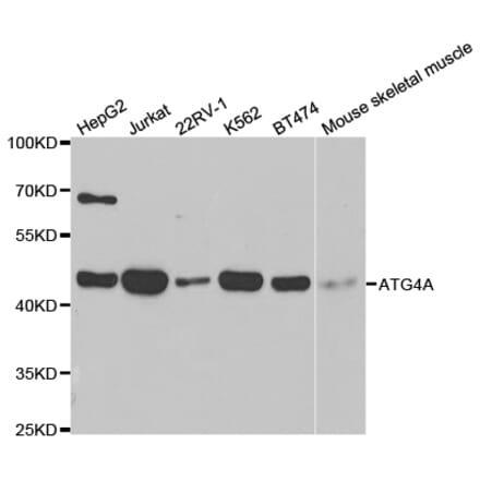 Anti-ATG4A Antibody from Bioworld Technology (BS7735) - Antibodies.com