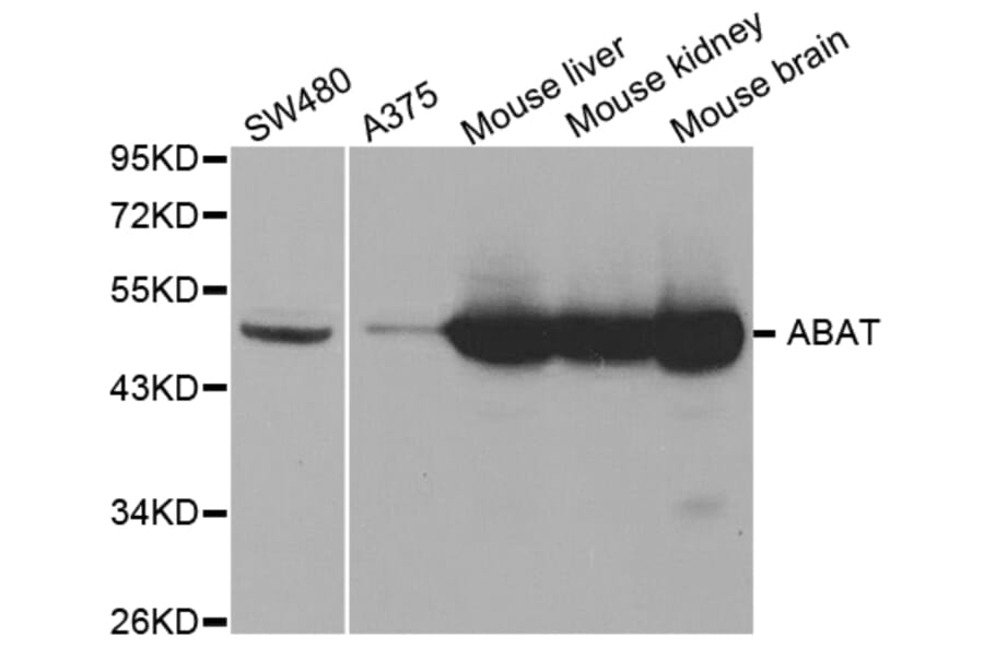 Anti-ABAT Antibody from Bioworld Technology (BS7743) - Antibodies.com