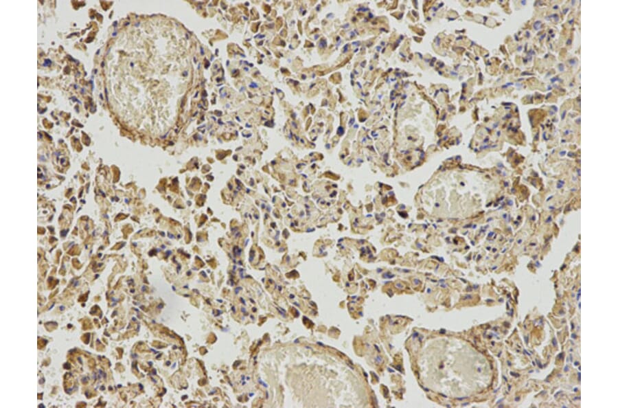 Anti-ABAT Antibody from Bioworld Technology (BS7743) - Antibodies.com