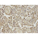 Anti-ABAT Antibody from Bioworld Technology (BS7743) - Antibodies.com