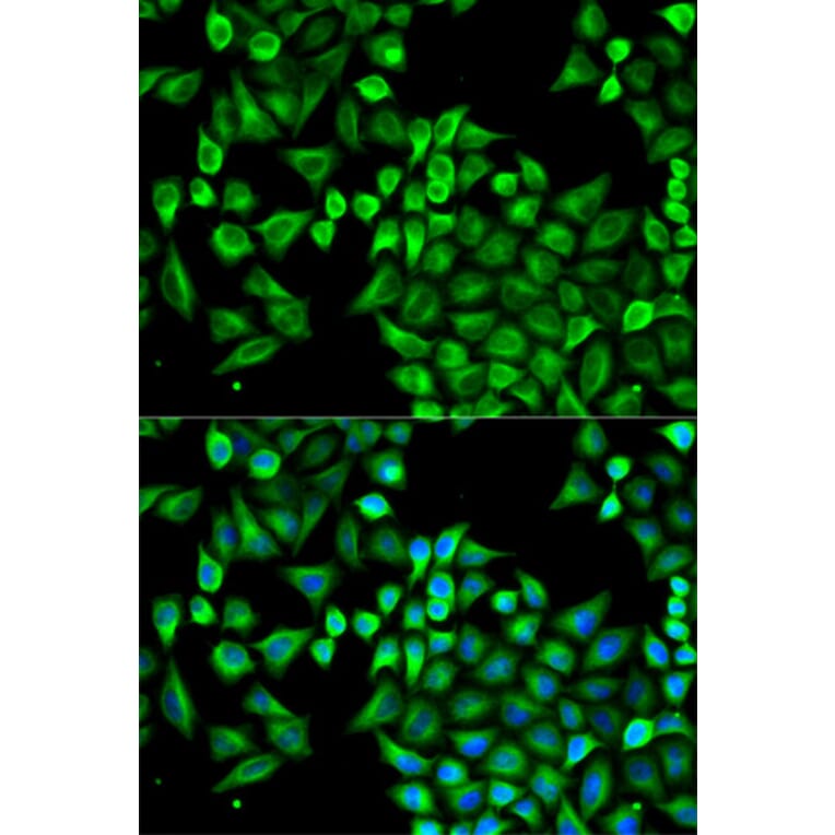 Anti-ABAT Antibody from Bioworld Technology (BS7743) - Antibodies.com