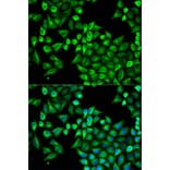 Anti-ABAT Antibody from Bioworld Technology (BS7743) - Antibodies.com