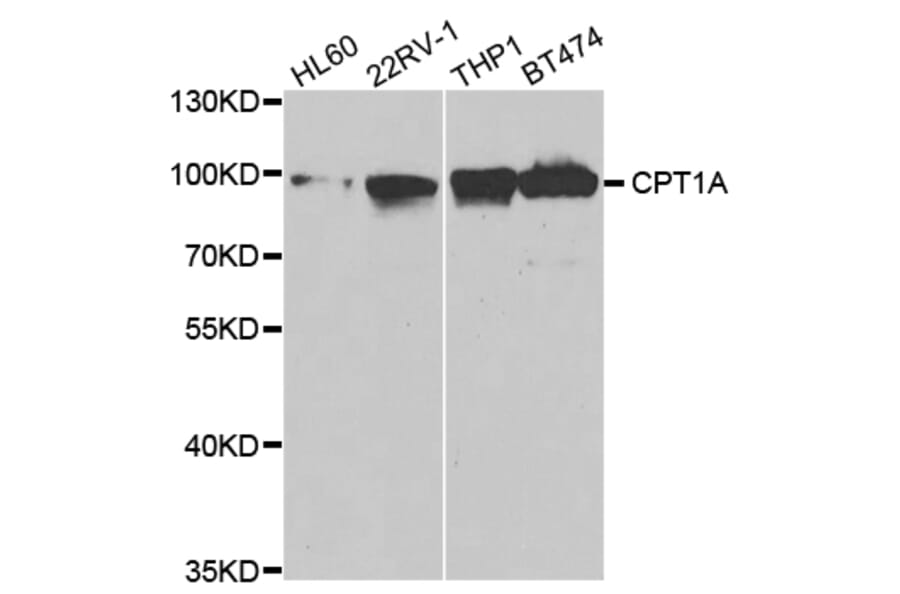 Anti-CPT1A Antibody from Bioworld Technology (BS7744) - Antibodies.com
