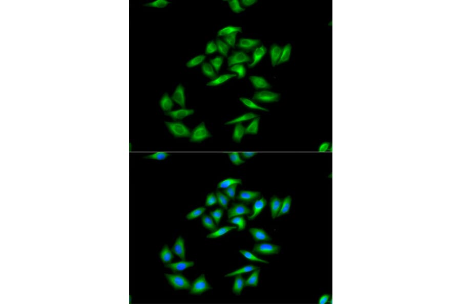 Anti-CPT1A Antibody from Bioworld Technology (BS7744) - Antibodies.com