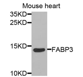 Anti-FABP3 Antibody from Bioworld Technology (BS7746) - Antibodies.com