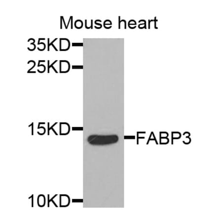 Anti-FABP3 Antibody from Bioworld Technology (BS7746) - Antibodies.com
