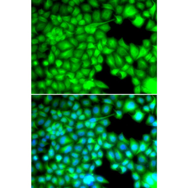 Anti-FABP3 Antibody from Bioworld Technology (BS7746) - Antibodies.com