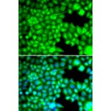 Anti-FABP3 Antibody from Bioworld Technology (BS7746) - Antibodies.com