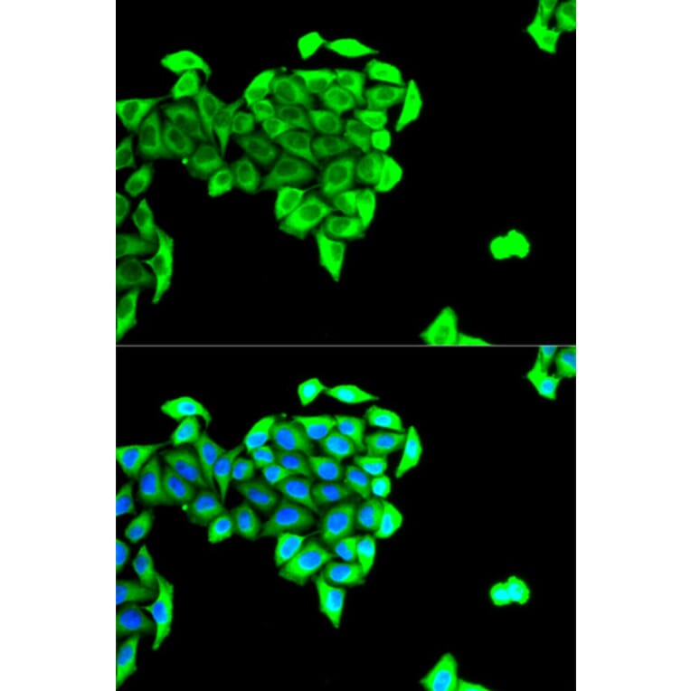 Anti-BAIAP2 Antibody from Bioworld Technology (BS7752) - Antibodies.com