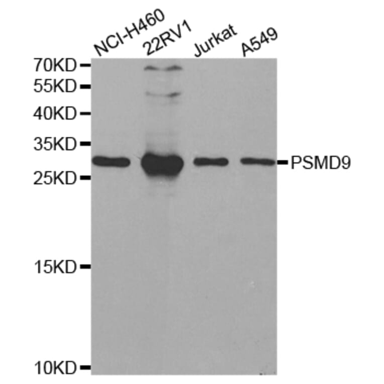 Anti-PSMD9 Antibody from Bioworld Technology (BS7754) - Antibodies.com