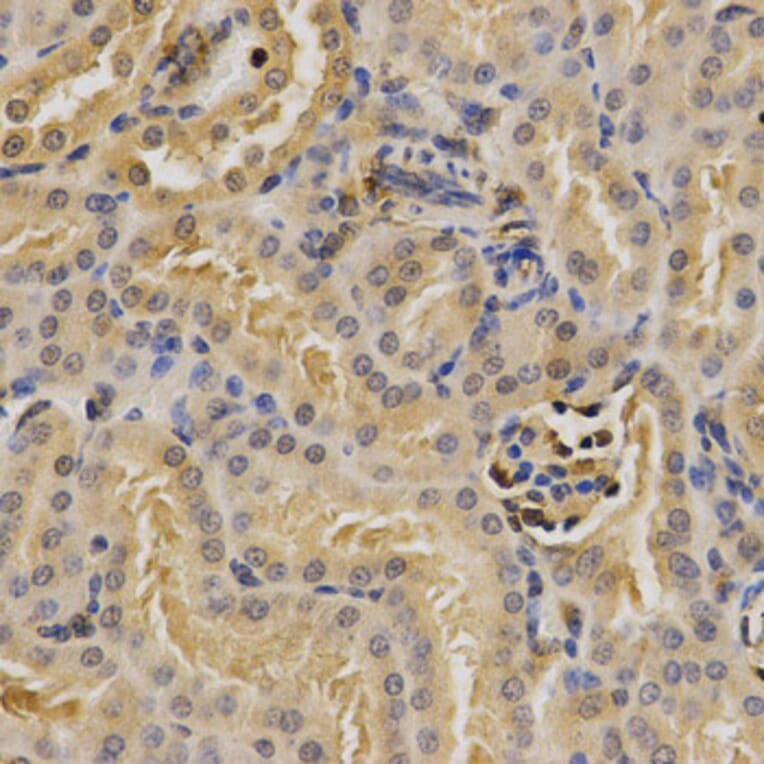 Anti-PSMD9 Antibody from Bioworld Technology (BS7754) - Antibodies.com