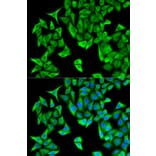 Anti-PSMD9 Antibody from Bioworld Technology (BS7754) - Antibodies.com
