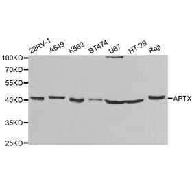 Anti-APTX Antibody from Bioworld Technology (BS7755) - Antibodies.com