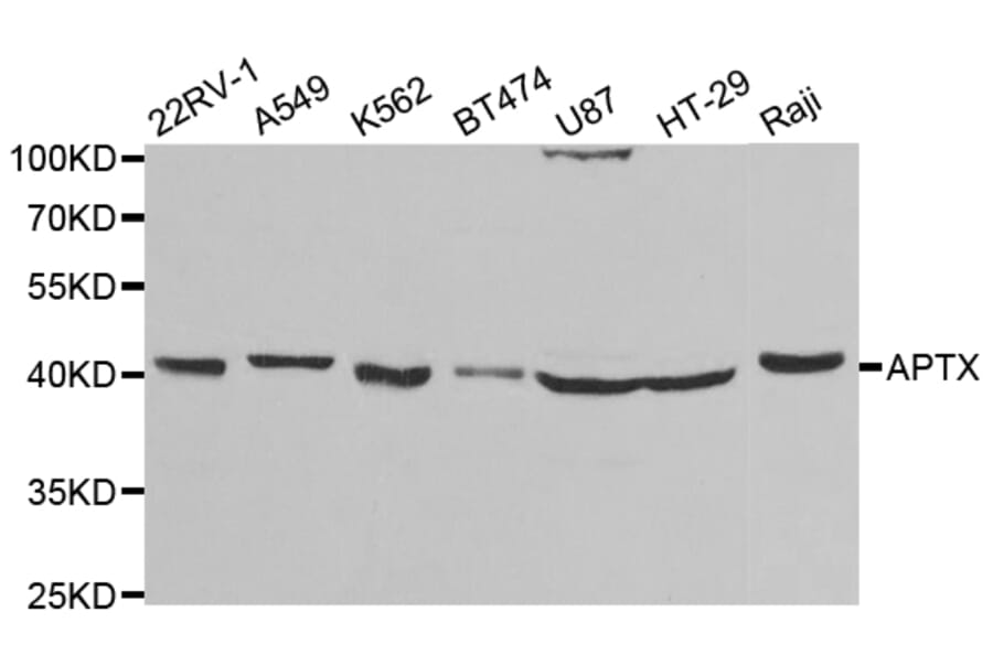 Anti-APTX Antibody from Bioworld Technology (BS7755) - Antibodies.com