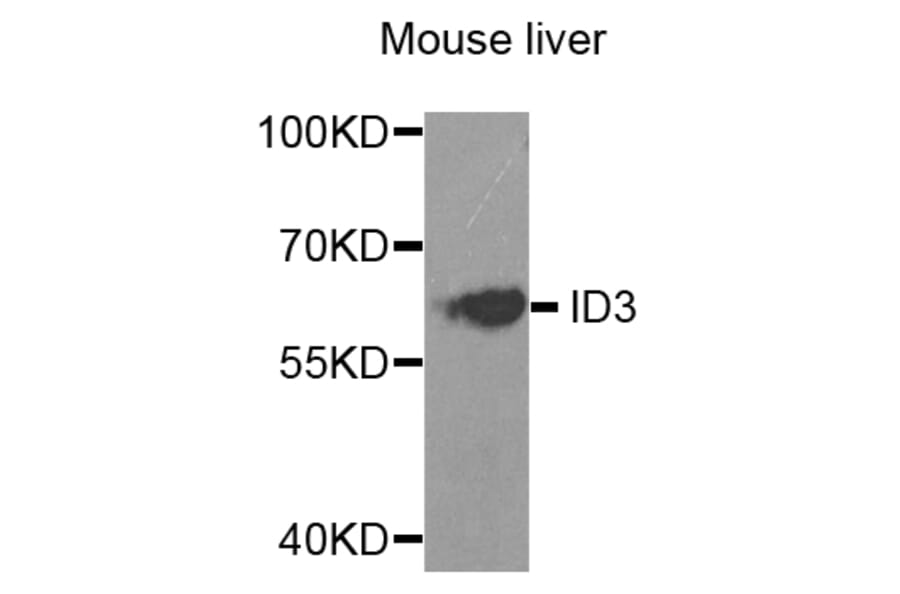 Anti-ID3 Antibody from Bioworld Technology (BS7756) - Antibodies.com