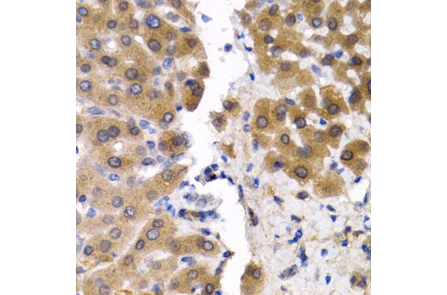 Anti-SCP2 Antibody from Bioworld Technology (BS7758) - Antibodies.com