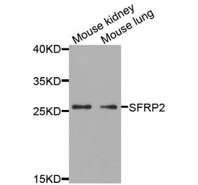Anti-SFRP2 Antibody from Bioworld Technology (BS7759) - Antibodies.com