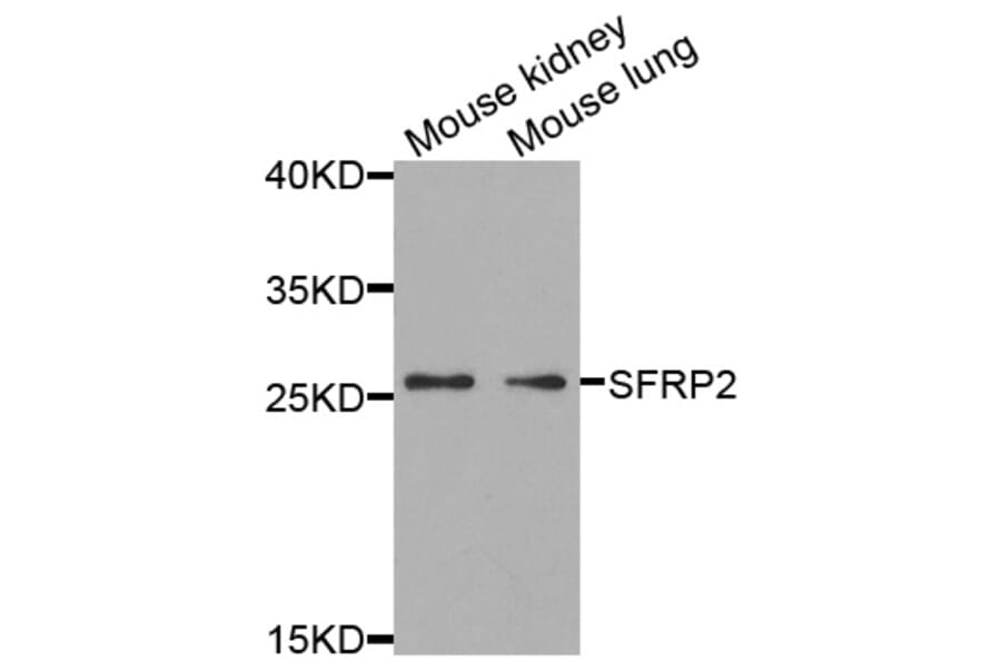 Anti-SFRP2 Antibody from Bioworld Technology (BS7759) - Antibodies.com