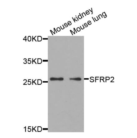 Anti-SFRP2 Antibody from Bioworld Technology (BS7759) - Antibodies.com