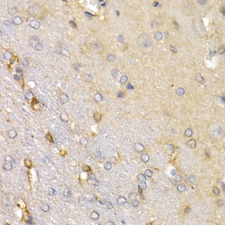 Anti-SFRP2 Antibody from Bioworld Technology (BS7759) - Antibodies.com