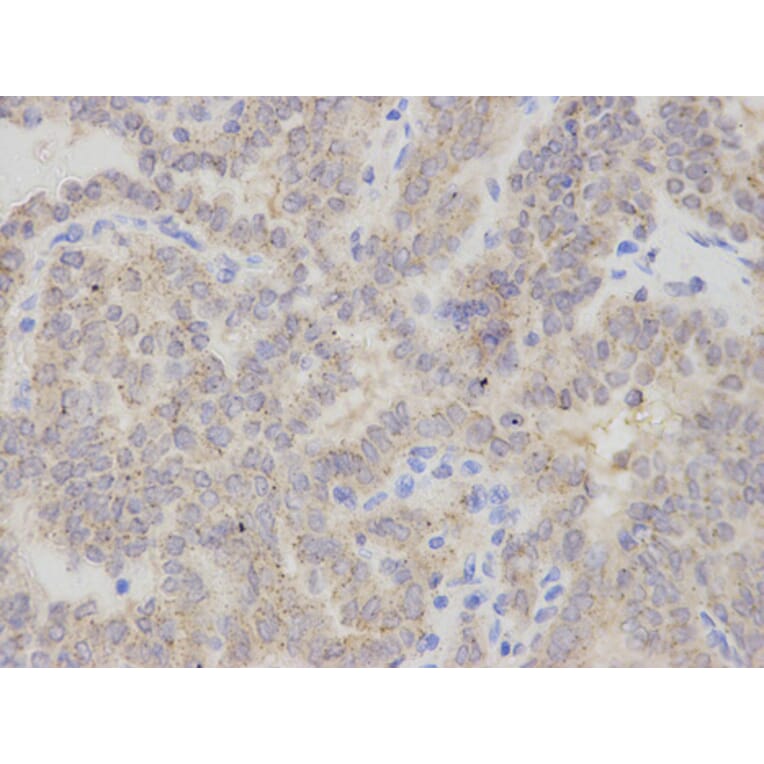 Anti-CHMP2B Antibody from Bioworld Technology (BS7767) - Antibodies.com