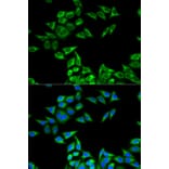 Anti-CHMP2B Antibody from Bioworld Technology (BS7767) - Antibodies.com